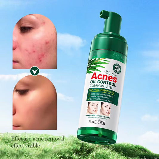 SADOER Tea Tree Acne Oil Control Clean Mousse – Deep Cleansing & Clear Skin Care ( The Savings Spot Sale )