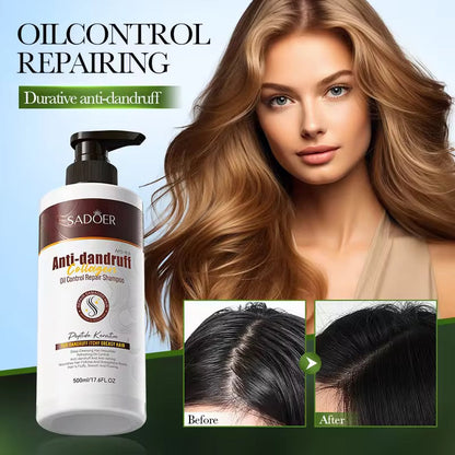 SADOER Anti-Dandruff Collagen Oil Control Repair Shampoo – Scalp Balance & Hair Strength ( The Savings Spot Sale )